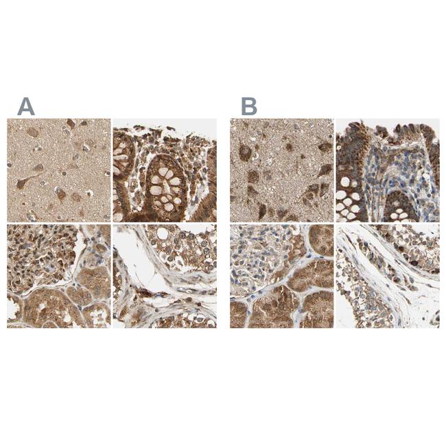 MRPS22 Antibody in Immunohistochemistry (IHC)