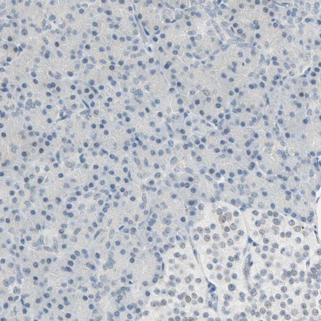 Brevican Antibody in Immunohistochemistry (Paraffin) (IHC (P))