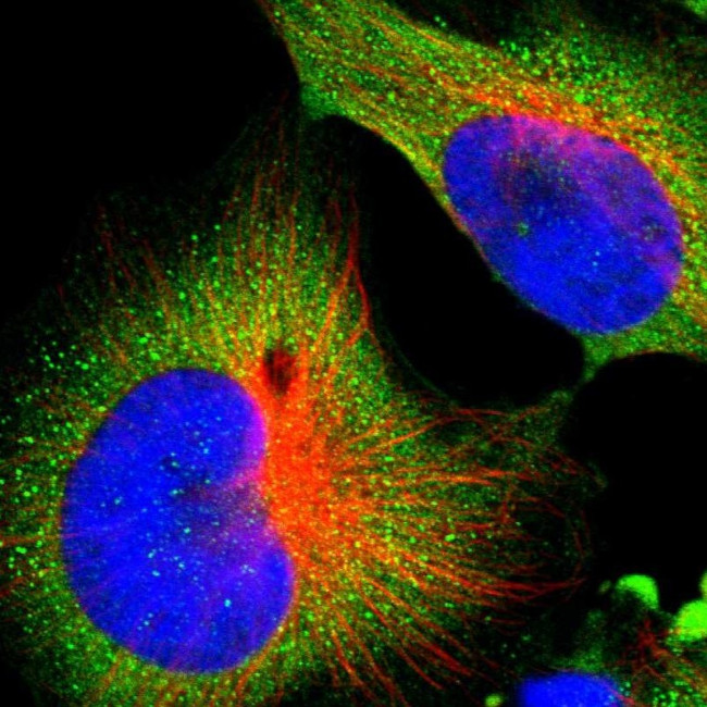 ALG5 Antibody in Immunocytochemistry (ICC/IF)