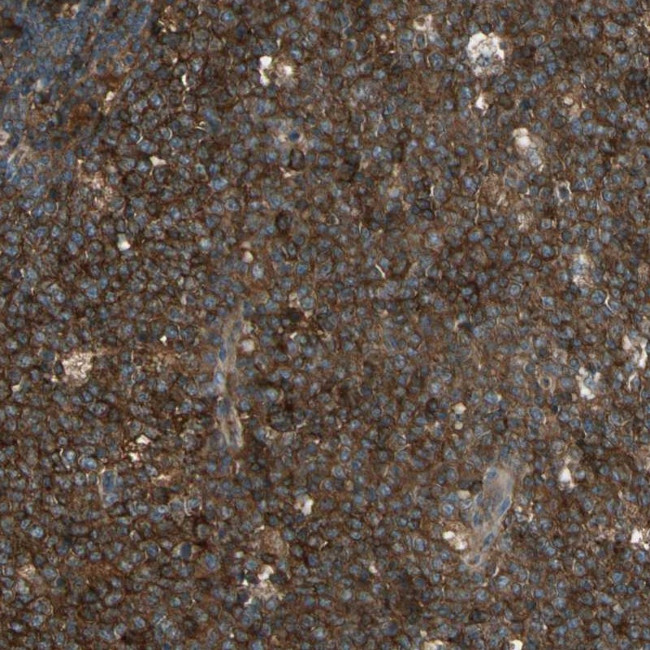 STX11 Antibody in Immunohistochemistry (Paraffin) (IHC (P))