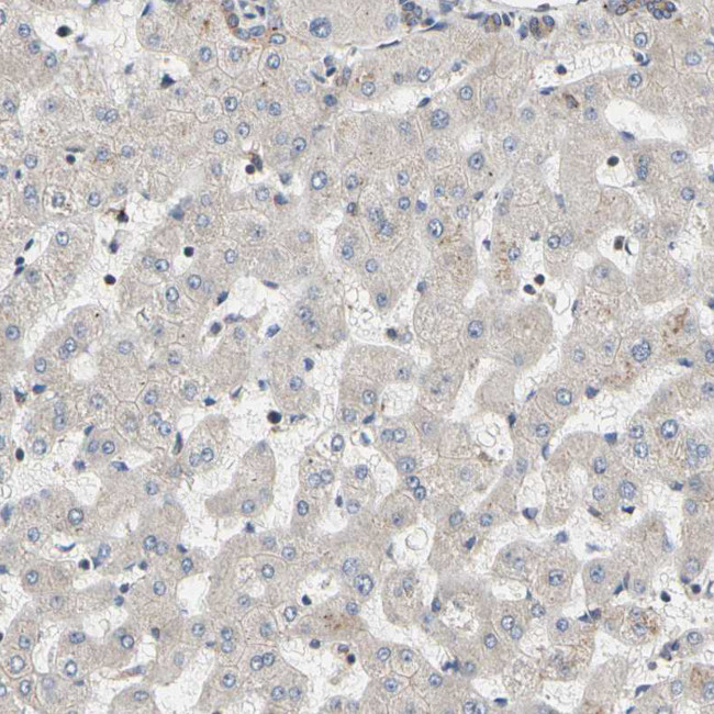 GPD2 Antibody in Immunohistochemistry (Paraffin) (IHC (P))