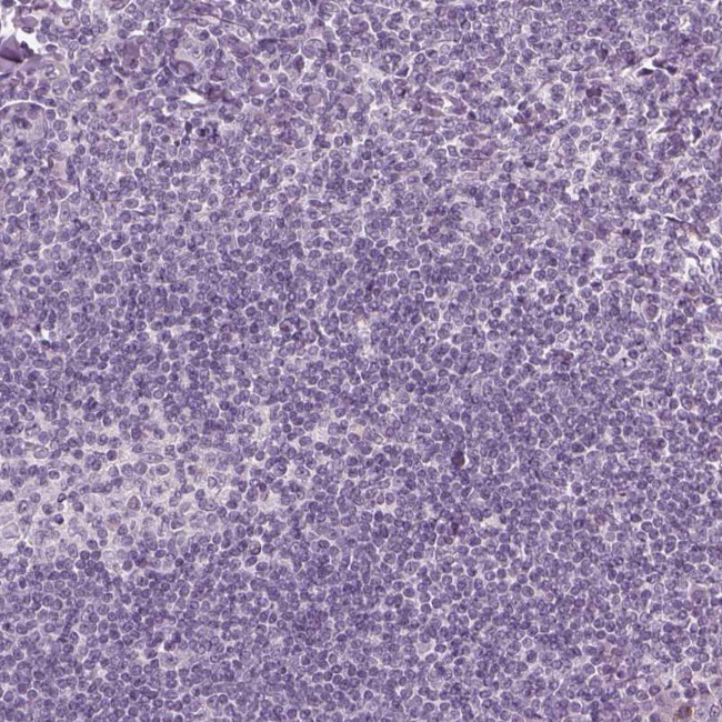 SLC6A17 Antibody in Immunohistochemistry (Paraffin) (IHC (P))