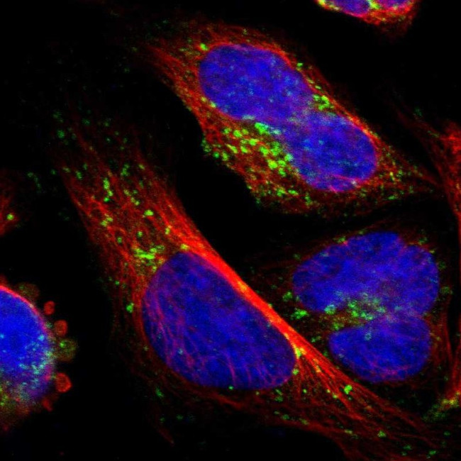 ATP6V1B2 Antibody in Immunocytochemistry (ICC/IF)