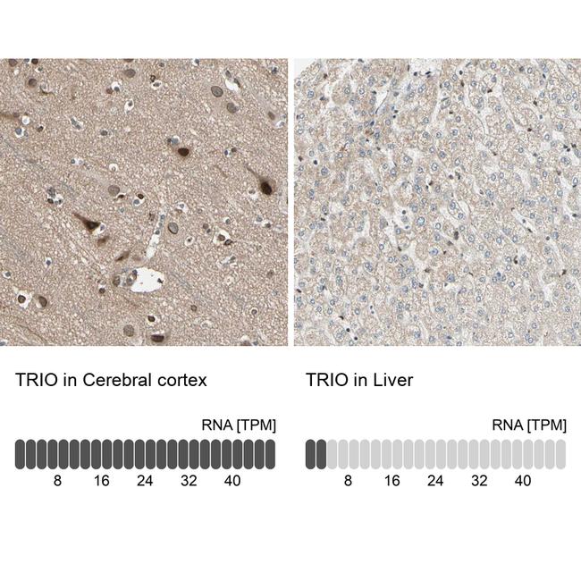 TRIO Antibody in Immunohistochemistry (IHC)