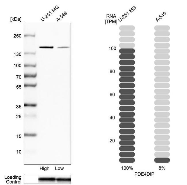 Myomegalin Antibody in Western Blot (WB)