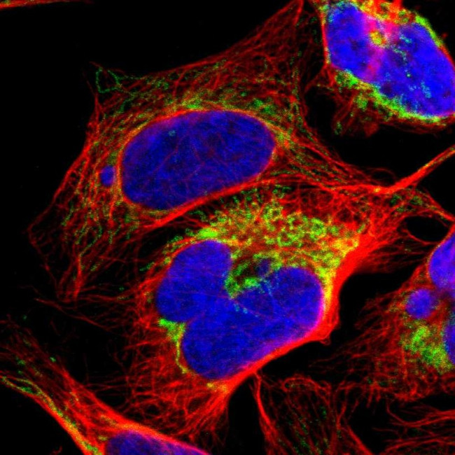 ME2 Antibody in Immunocytochemistry (ICC/IF)