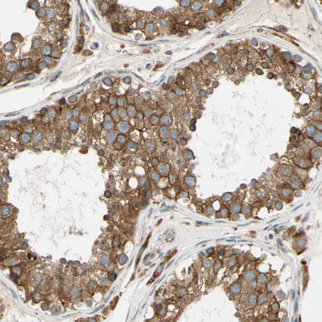 Ribophorin II Antibody in Immunohistochemistry (Paraffin) (IHC (P))