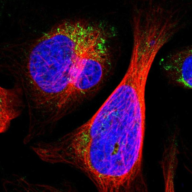 ALDH18A1 Antibody in Immunocytochemistry (ICC/IF)