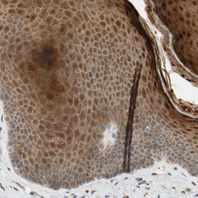 GPSM2 Antibody in Immunohistochemistry (Paraffin) (IHC (P))