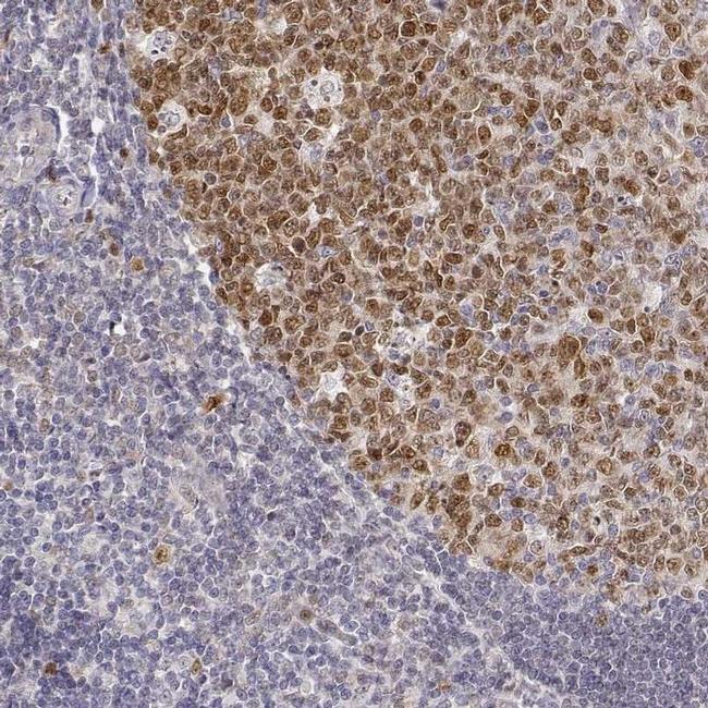 EAF2 Antibody in Immunohistochemistry (IHC)