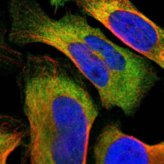 TCP-1 eta Antibody in Immunocytochemistry (ICC/IF)