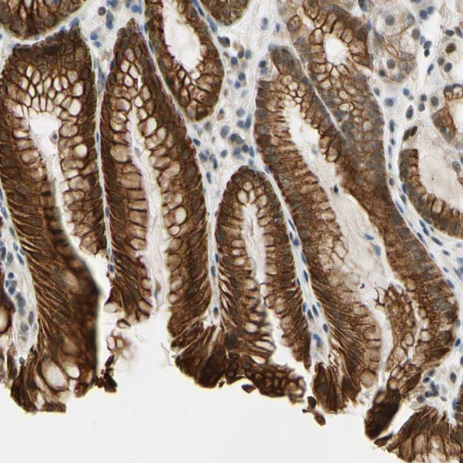 TAF12 Antibody in Immunohistochemistry (Paraffin) (IHC (P))