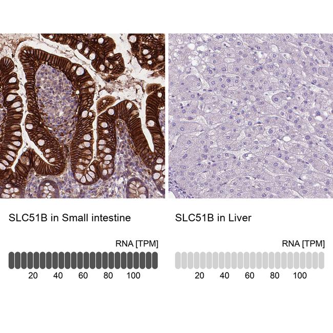 SLC51B Antibody in Immunohistochemistry (IHC)