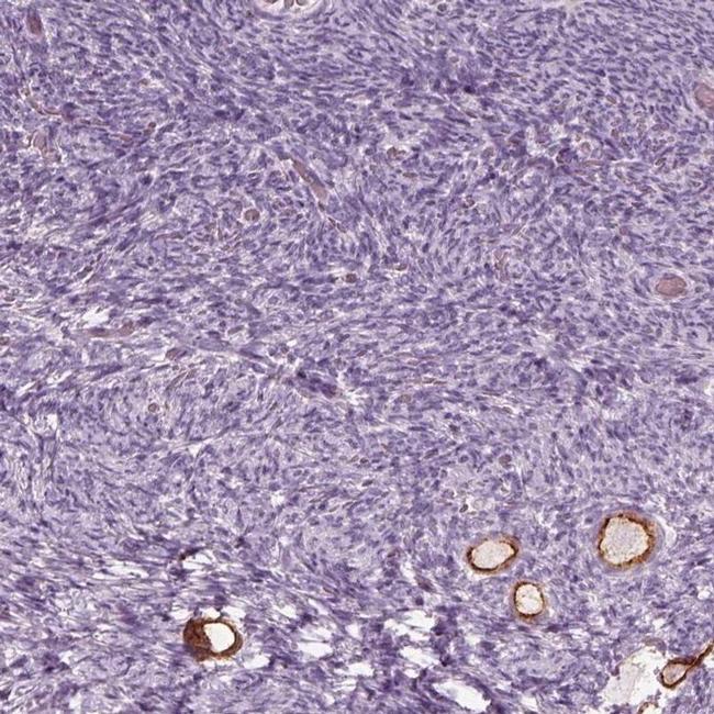 ZP4 Antibody in Immunohistochemistry (IHC)