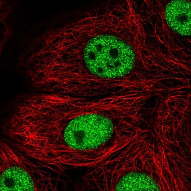 TBX2 Antibody in Immunocytochemistry (ICC/IF)