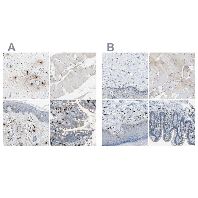 Carboxypeptidase A3 Antibody in Immunohistochemistry (IHC)