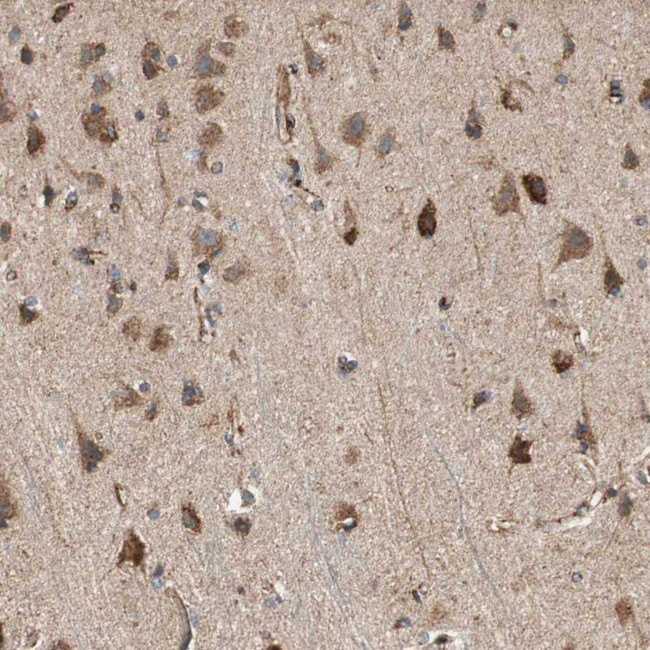 AKAP1 Antibody in Immunohistochemistry (Paraffin) (IHC (P))