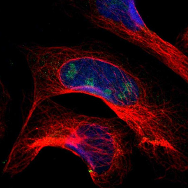 PITX1 Antibody in Immunocytochemistry (ICC/IF)