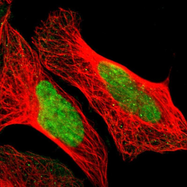 POGZ Antibody in Immunocytochemistry (ICC/IF)