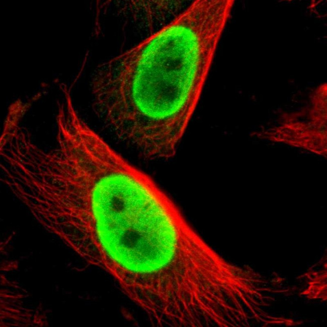 FUS Antibody in Immunocytochemistry (ICC/IF)