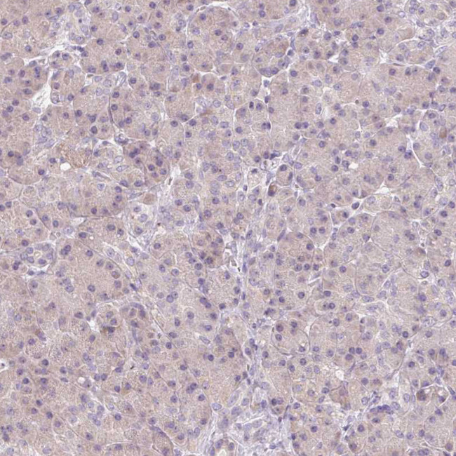 v-Myb Antibody in Immunohistochemistry (Paraffin) (IHC (P))