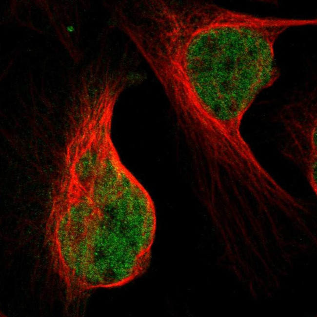 NFIA Antibody in Immunocytochemistry (ICC/IF)