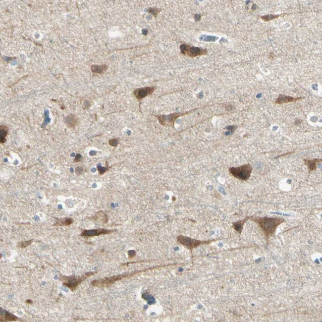 AATK Antibody in Immunohistochemistry (Paraffin) (IHC (P))