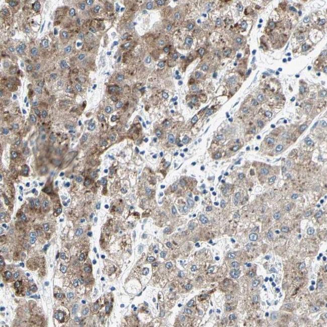 CYP2E1 Antibody in Immunohistochemistry (IHC)