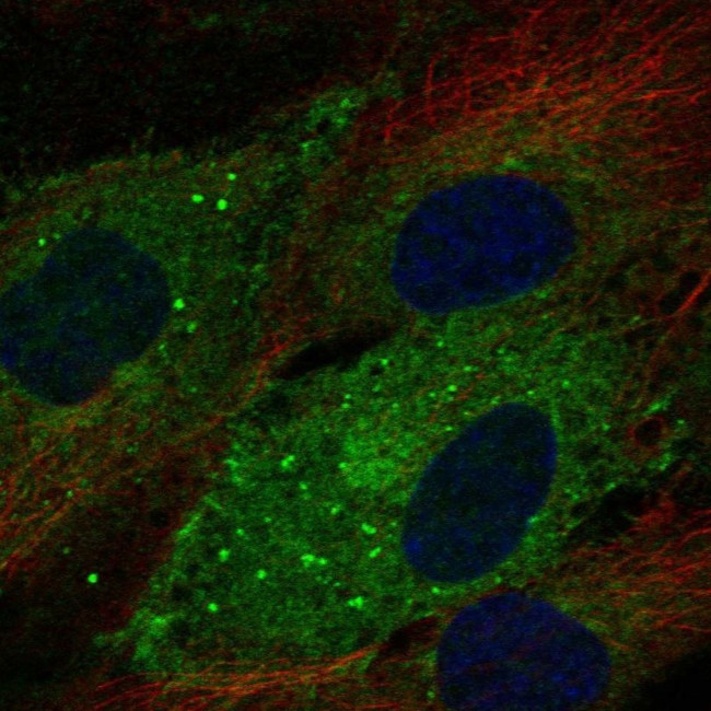 CD93 Antibody in Immunocytochemistry (ICC/IF)