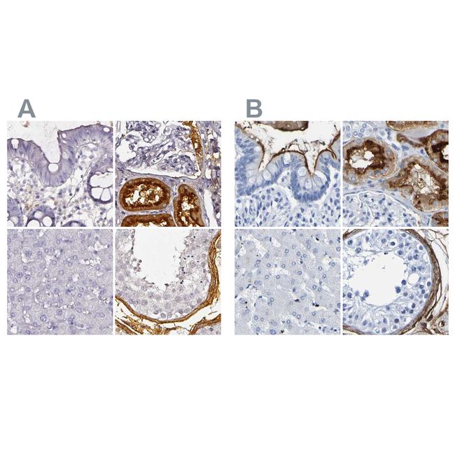 DPEP1 Antibody in Immunohistochemistry (IHC)