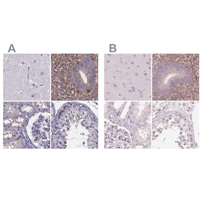 SFRP4 Antibody in Immunohistochemistry (IHC)