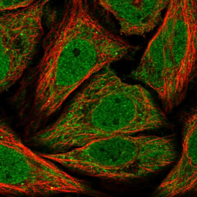 TIM17 Antibody in Immunocytochemistry (ICC/IF)