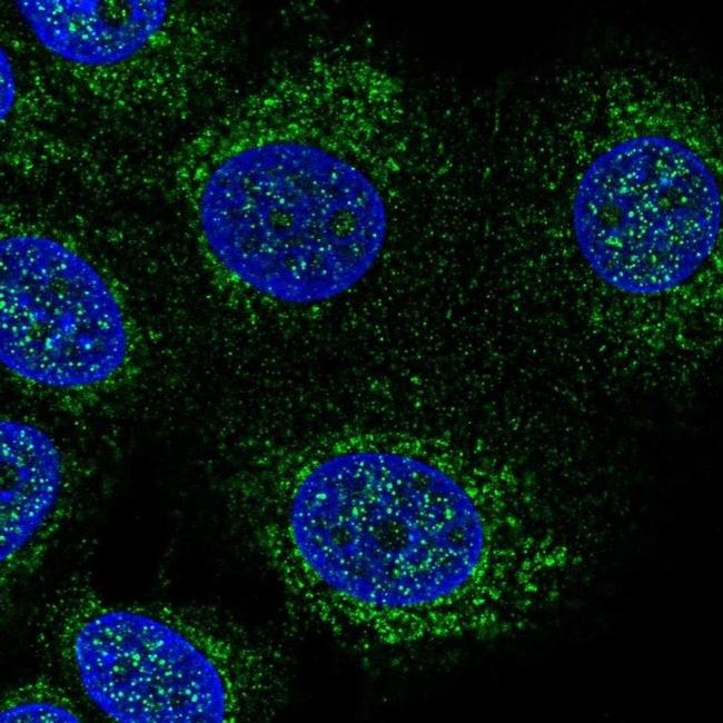 DHODH Antibody in Immunocytochemistry (ICC/IF)