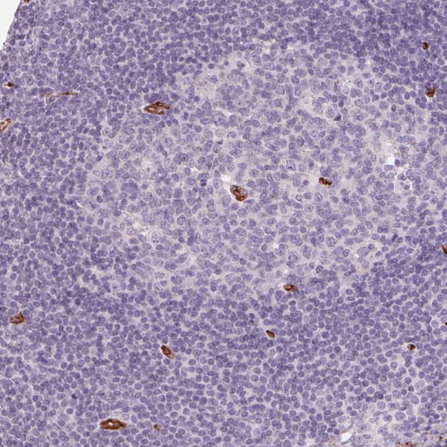 CLPS Antibody in Immunohistochemistry (Paraffin) (IHC (P))