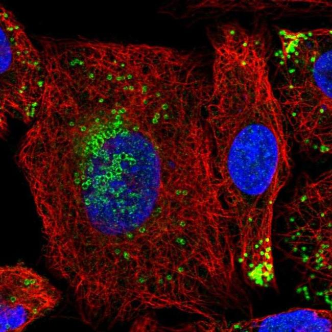 HIG2 Antibody in Immunocytochemistry (ICC/IF)