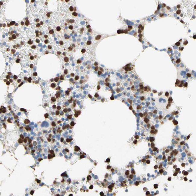 IkB zeta Antibody in Immunohistochemistry (Paraffin) (IHC (P))