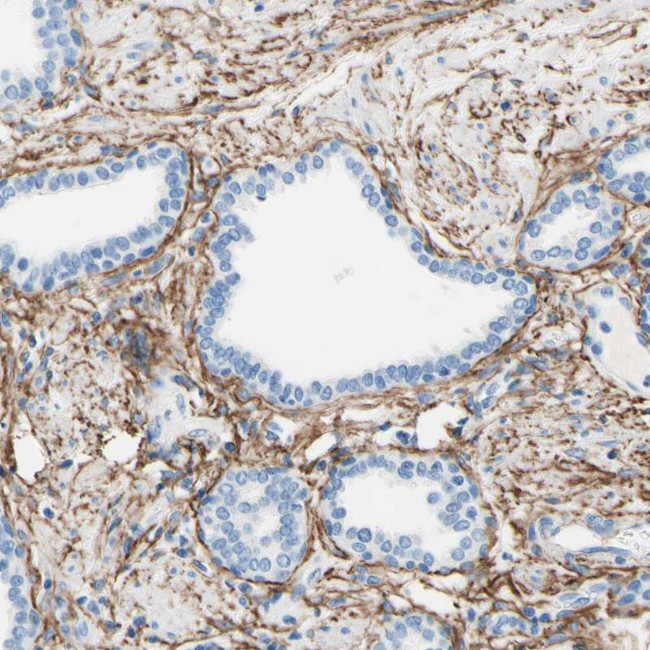 MFAP5 Antibody in Immunohistochemistry (Paraffin) (IHC (P))