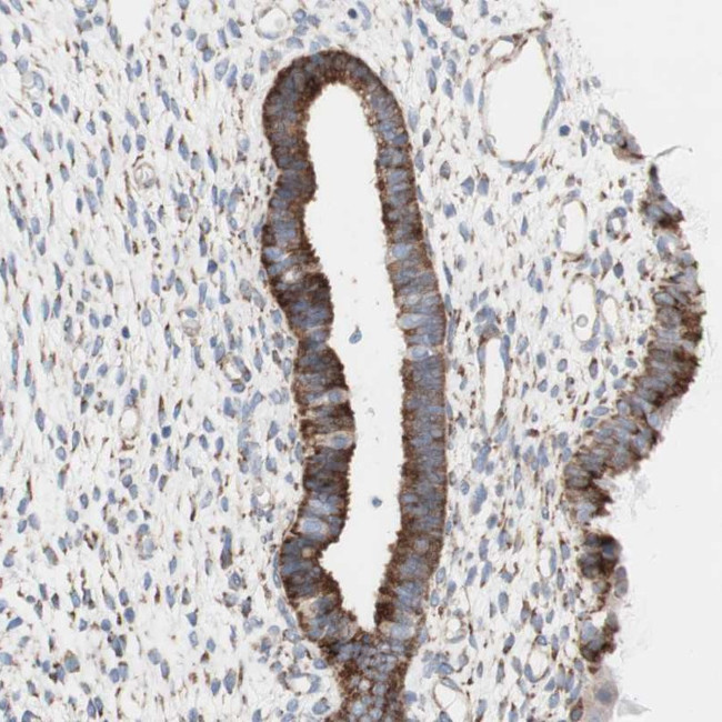 AGPAT5 Antibody in Immunohistochemistry (Paraffin) (IHC (P))