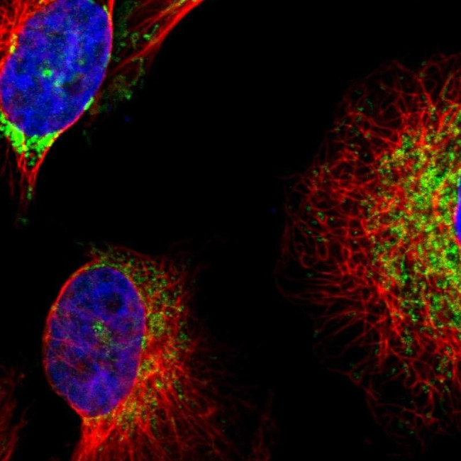 CLPP Antibody in Immunocytochemistry (ICC/IF)