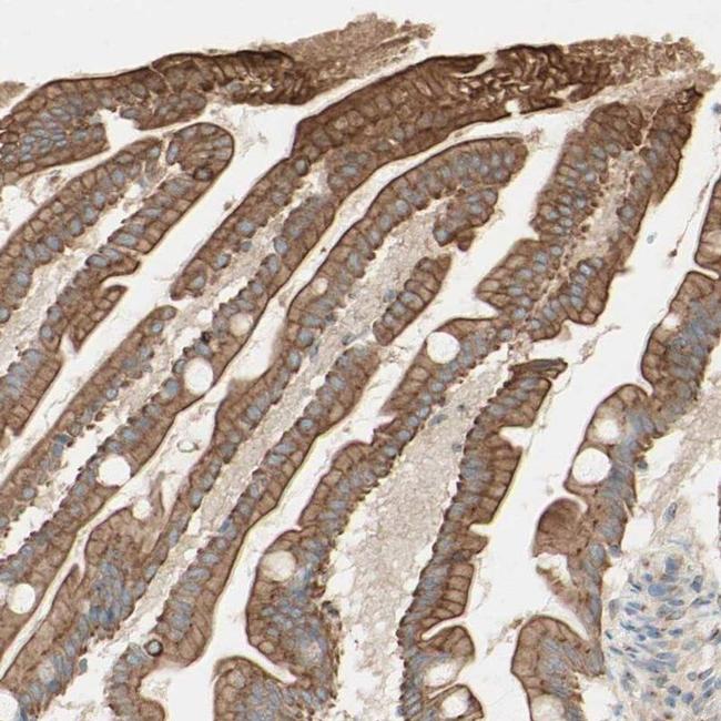 MTM1 Antibody in Immunohistochemistry (IHC)