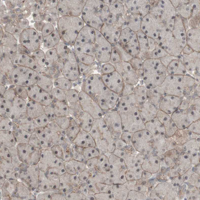 ALOX12 Antibody in Immunohistochemistry (Paraffin) (IHC (P))