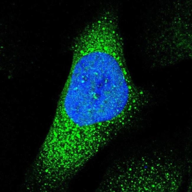 ABHD3 Antibody in Immunocytochemistry (ICC/IF)