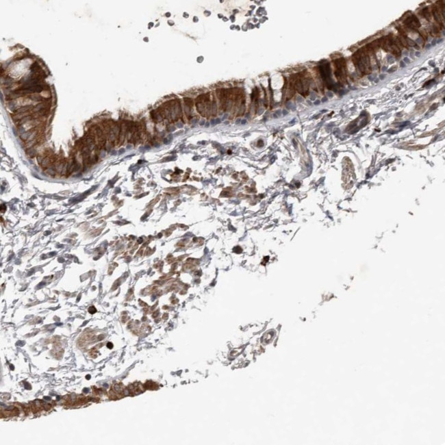 BAMBI Antibody in Immunohistochemistry (Paraffin) (IHC (P))