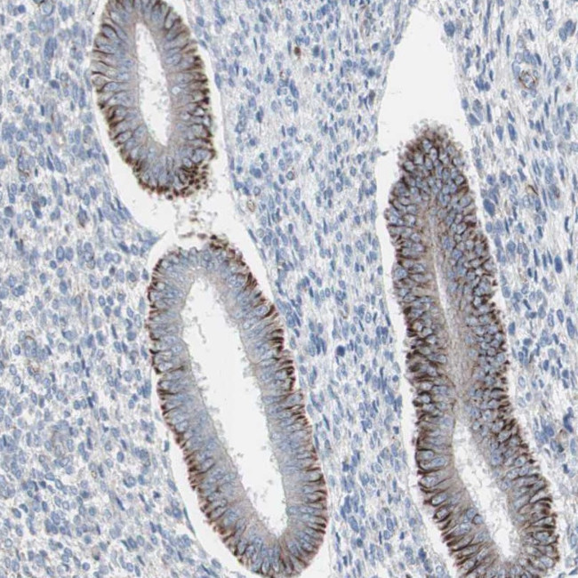 AGPAT5 Antibody in Immunohistochemistry (Paraffin) (IHC (P))