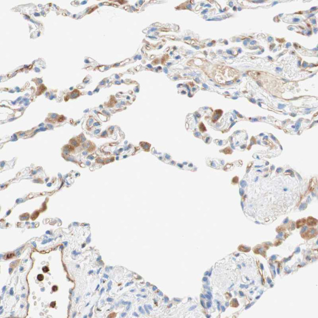 Stomatin Antibody in Immunohistochemistry (Paraffin) (IHC (P))