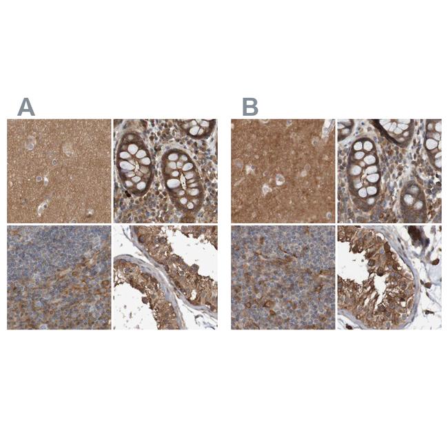 ARHGEF11 Antibody in Immunohistochemistry (IHC)