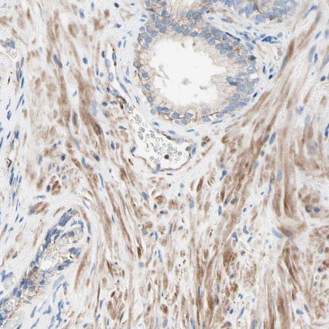 SEMA4C Antibody in Immunohistochemistry (IHC)