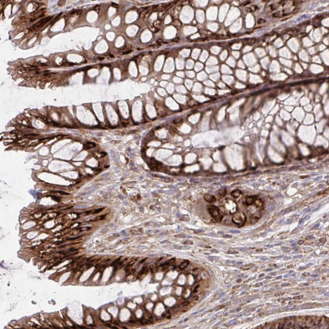 ASAP1 Antibody in Immunohistochemistry (Paraffin) (IHC (P))