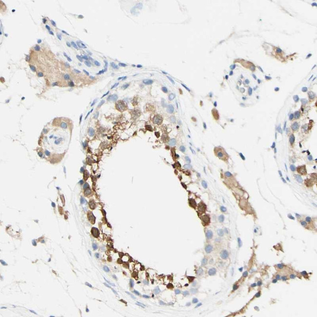 FGF4 Antibody in Immunohistochemistry (Paraffin) (IHC (P))