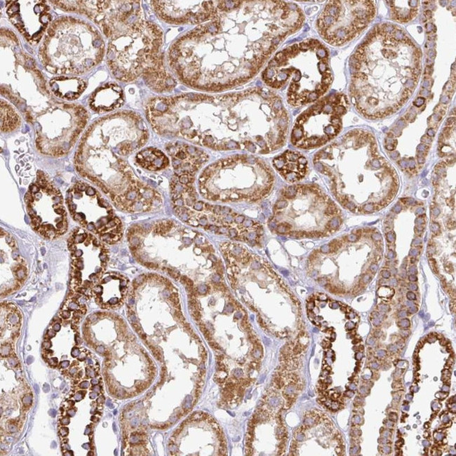 ZNF211 Antibody in Immunohistochemistry (Paraffin) (IHC (P))